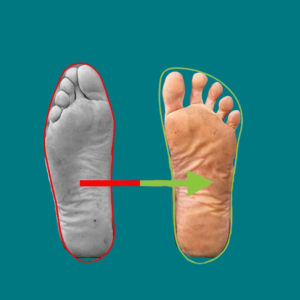 avis d'expérience sur les toe spacer