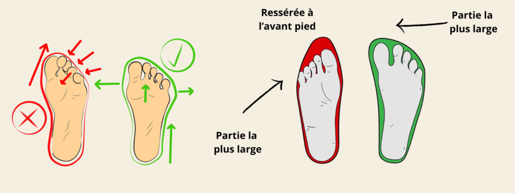 chaussures bonnes pour les hallux valgus